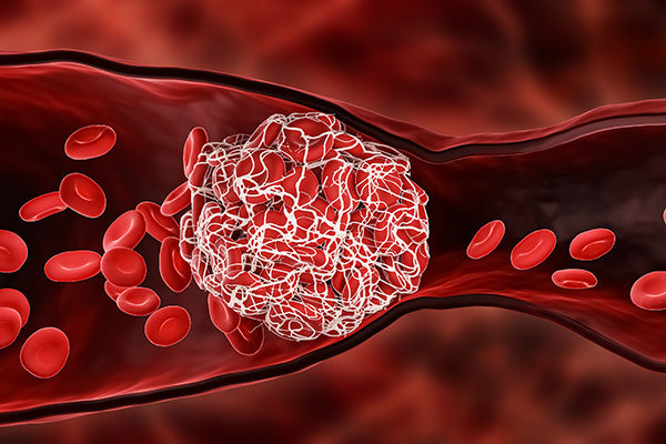 Blood Clot