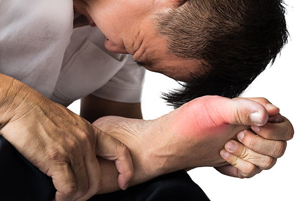 Gout and Hyperuricemia